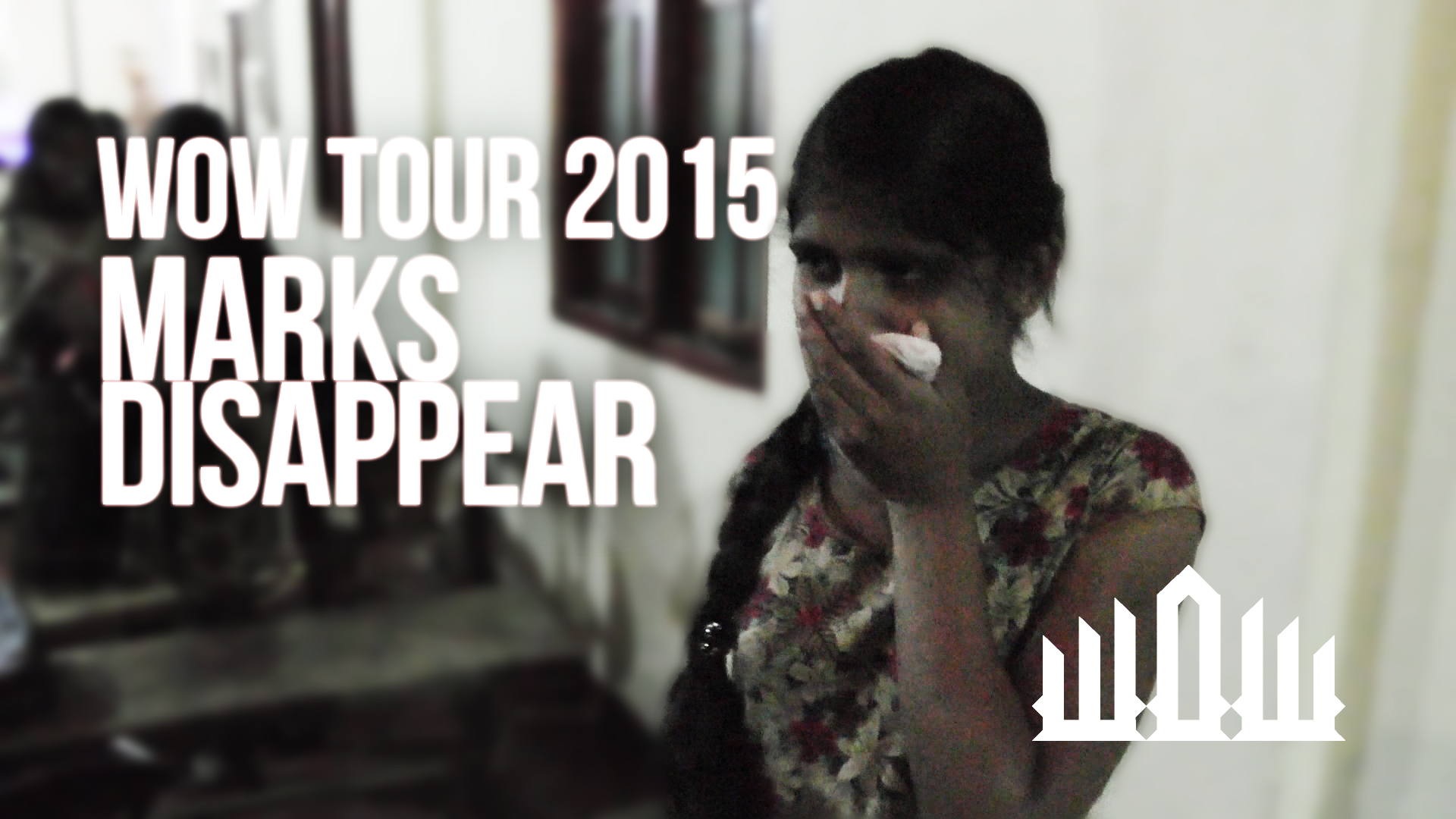 BIRTHMARKS DISAPPEAR – WOW TOUR 2015 – KIRBY DE LANEROLLE